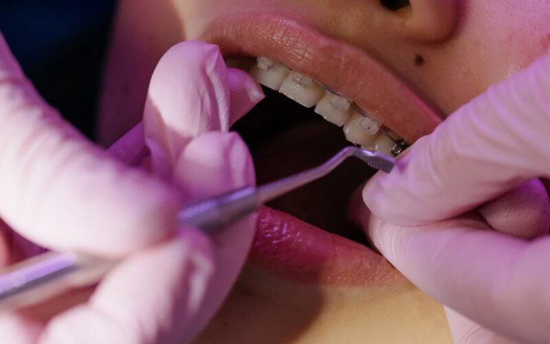 Kompleksowa opieka stomatologiczna w Tarnowie - ortodoncja i stomatologia